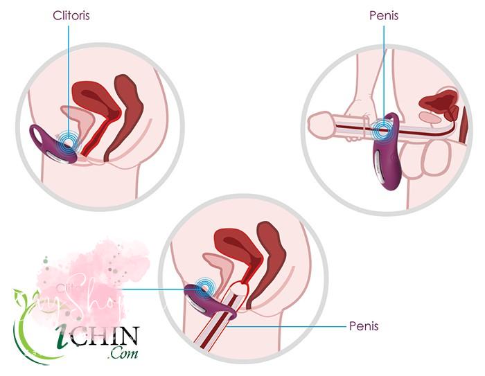 cách đeo vòng đeo cu - Oichin