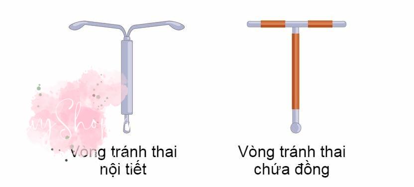 7 tác dụng phụ khi đặt vòng tránh thai bạn nên cân nhắc
